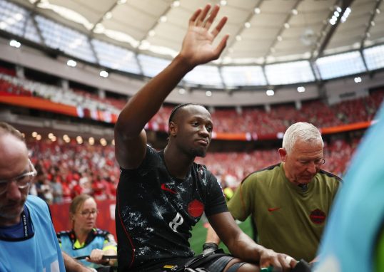 Canada’s Kone undergoes major leg surgery; to miss rest of World Cup